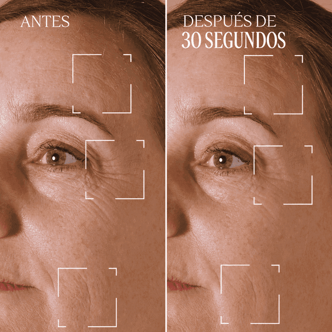 Tratamiento para Arrugas Localizadas Immortelle Divina Normal BLOC40672 