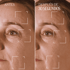 Tratamiento para Arrugas Localizadas Immortelle Divina Normal BLOC40672 