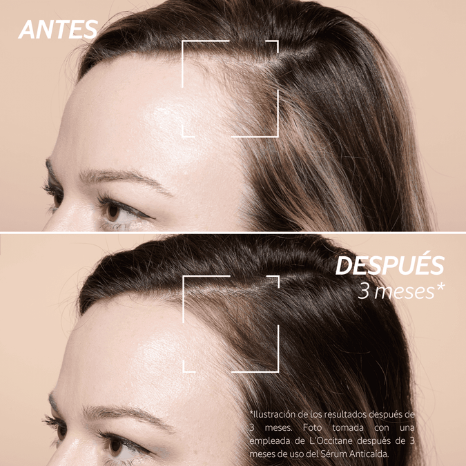 Serum Anticaída de Cabello Normal BLOC03618 